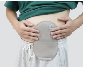 which colostomy bag is the best