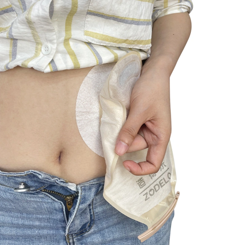 how to change a colostomy pouch？