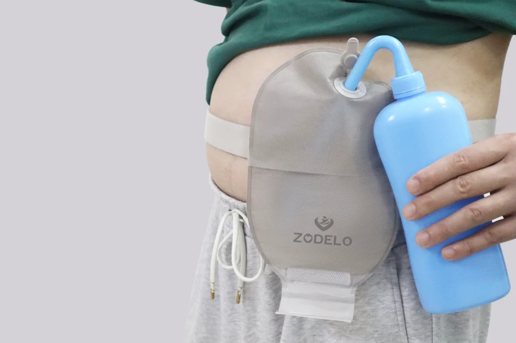 When to empty your ostomy bag?