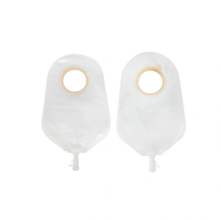 What Is A Urostomy Bag