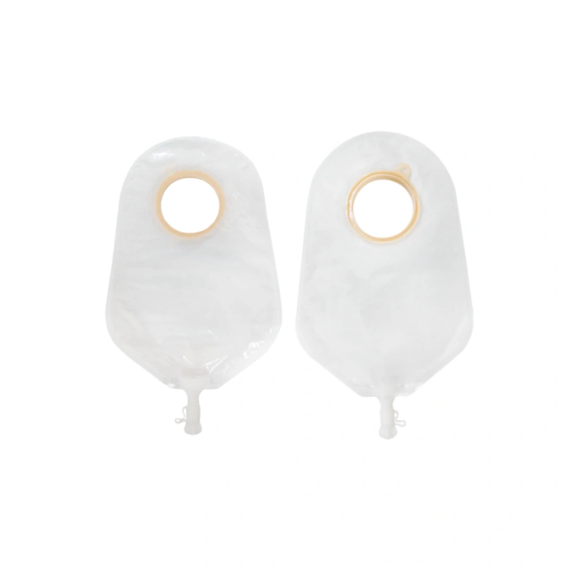 What Is A Urostomy Bag