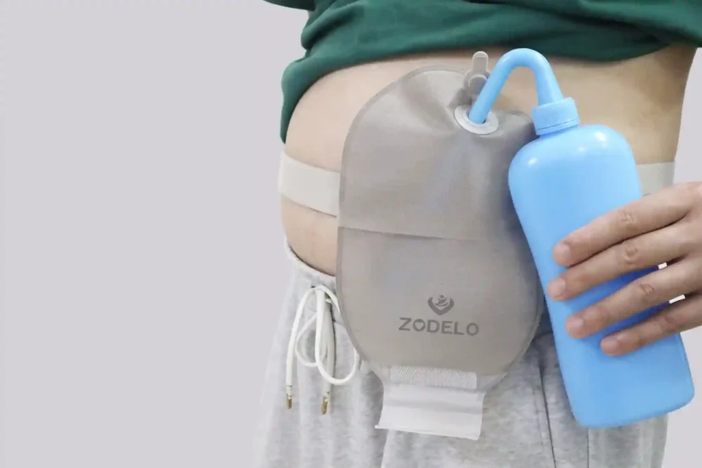 Difference Between J Pouch And Colostomy