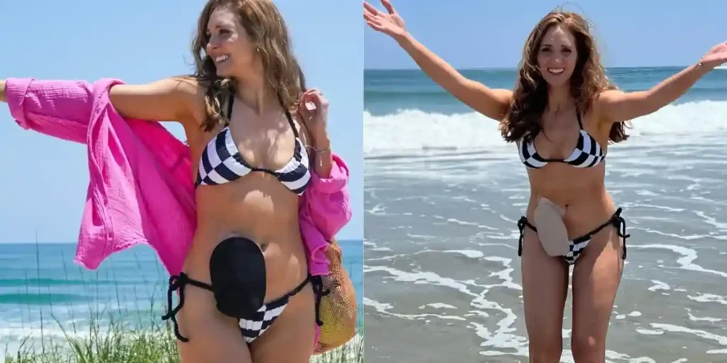 Can I Go Swimming With A Colostomy Bag？