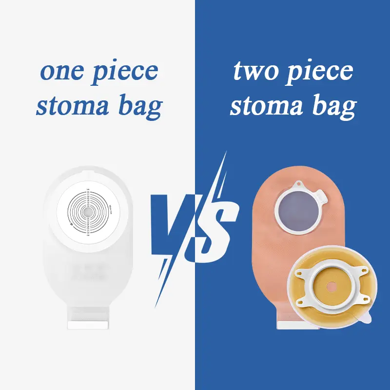 One Piece Vs Two Piece Stoma Bag