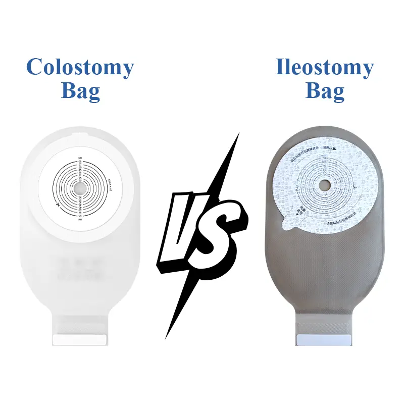 Colostomy Bag Vs Ileostomy Bag：What’S The Difference?