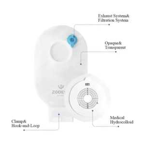 advantages of colostomy bag