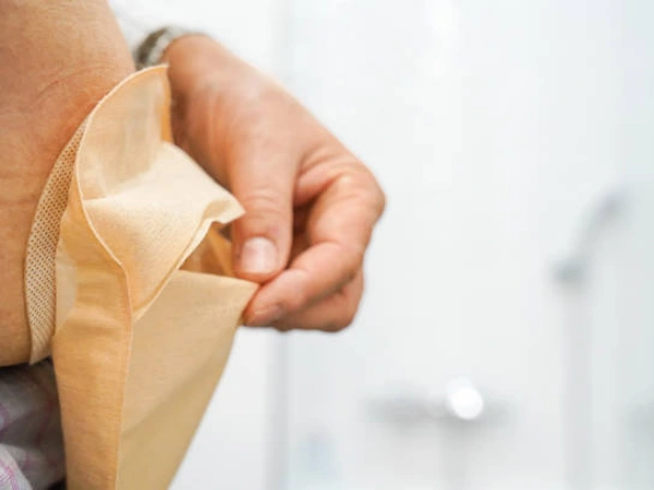 top 10 colostomy bag manufacturers in india 2026